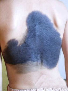 3. 富贵痣与文化创造力