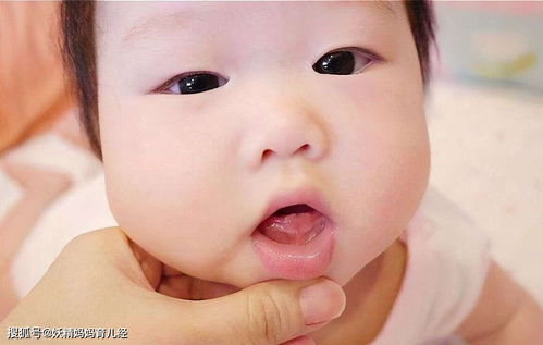 面相学视角下孩子嘴唇黏液病变之探究
