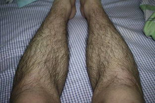 毛发与肤色因素