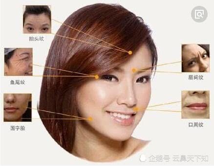 三、 表情肌活动导致动态皱纹及其转化为静态皱纹的机制