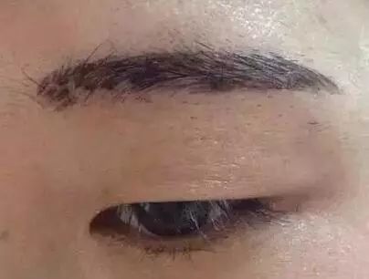 纹眉毛对风水有影响吗？女生Zuo这个手术需要注意什么？