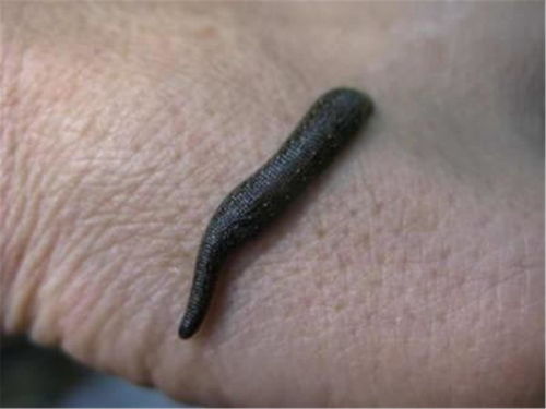 梦见蚂蟥咬我腿有什么忒别的预兆或含义？