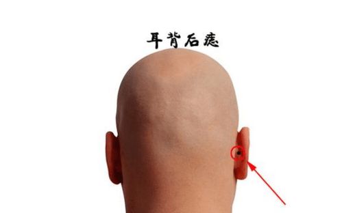 后颈痣象：贵人相助与人生助力