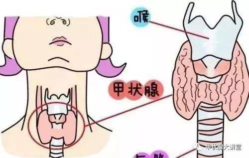 甲状腺问题