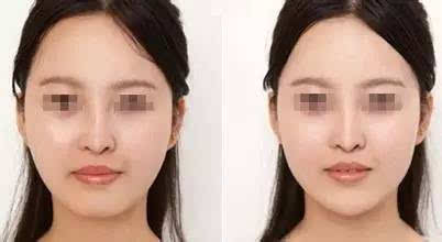 一、  圆润丰隆之相：双下巴并非赘肉，而是福德深厚的显性表征