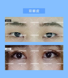 如何将八字眉单眼皮小眼睛改造成川字眉？
