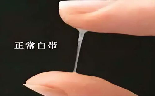 应对方法：冬日“除臭”指南