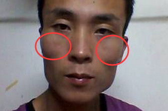7. 较大腮骨配合薄耳朵（缺乏刹车功能）