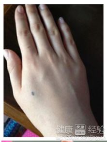 临床干预与治疗策略