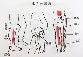 足面及足底胎记：命运密码的隐匿载体