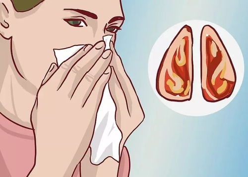 过敏性鼻炎的分型