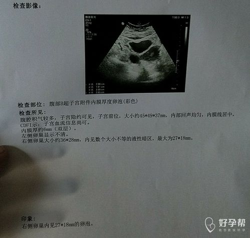 三、我的亲身体验：不是全部人都能顺利完成B超！