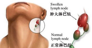 颈部锁骨：气血循环与苦情宿命