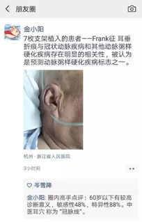 前言