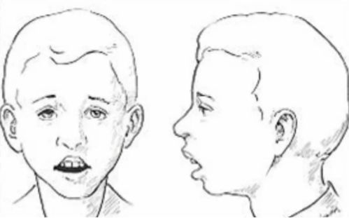 脸上穿刺会对家居风水产生怎样的影响？