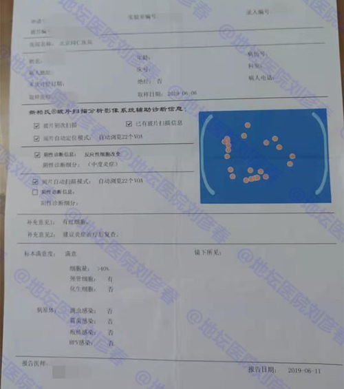 宫颈炎引起尿频尿急到底咋办？