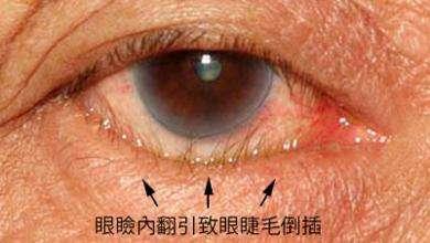 二、  印堂气色对事业财运的宏观影响