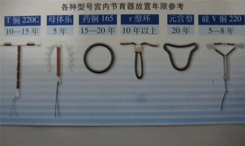 采用圆宫型环的注意事项