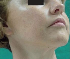 三、 健康评估与医疗干预的必要性