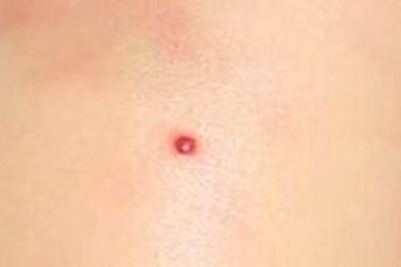 1. 五行八字视角下的“局部色素”概念