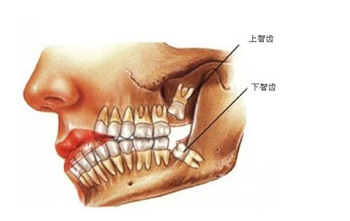 智齿为何既叫爱情齿又称为智慧齿？