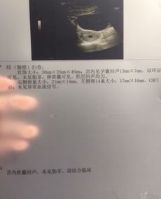 停经35天卵黄囊可见吗？