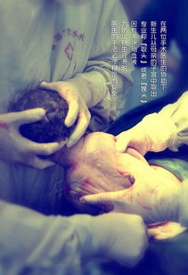 二、 剖腹产择日的理论依据与实践要求