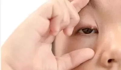 二、 医学视角：眼睑痉挛及相关症状解析