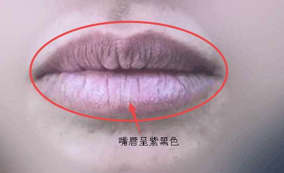 5．丰满嘴唇——财富感召力与商业敏锐度