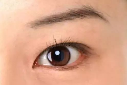 梦见以故奶奶眼睛发黑，是预示着什么不祥的征兆吗？