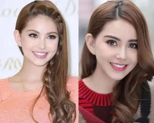 二、 鼻梁弧度与侧脸轮廓的协同效应
