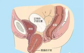 二、饮食法宝：吃出弹性来！