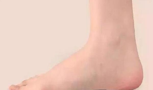 脚一边长一边短，女生第二个脚短算命，这是正常的生理现象吗？