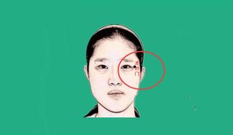 “奸门”凹陷之象与婚姻波折的关联