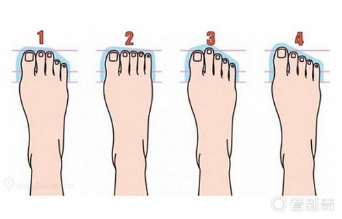 罗马脚：均衡稳健的人生态度