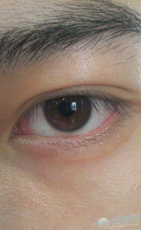 面相三白眼代表什么性格或命运？