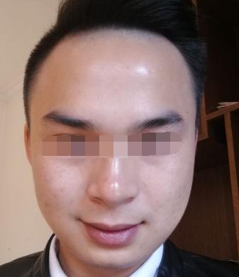 鹿鼻：稳重仁爱的守护者