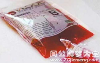 梦见大量出血是什么预兆？周公解梦如何解释？