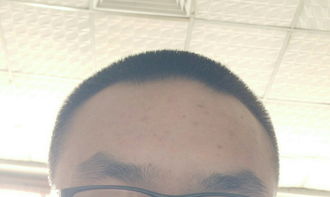 “天庭”的象征意义：阳气充盈与生命枢纽