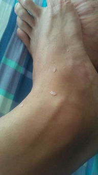 不同位置胎记的独特特点：基于相术及经验积累的解读