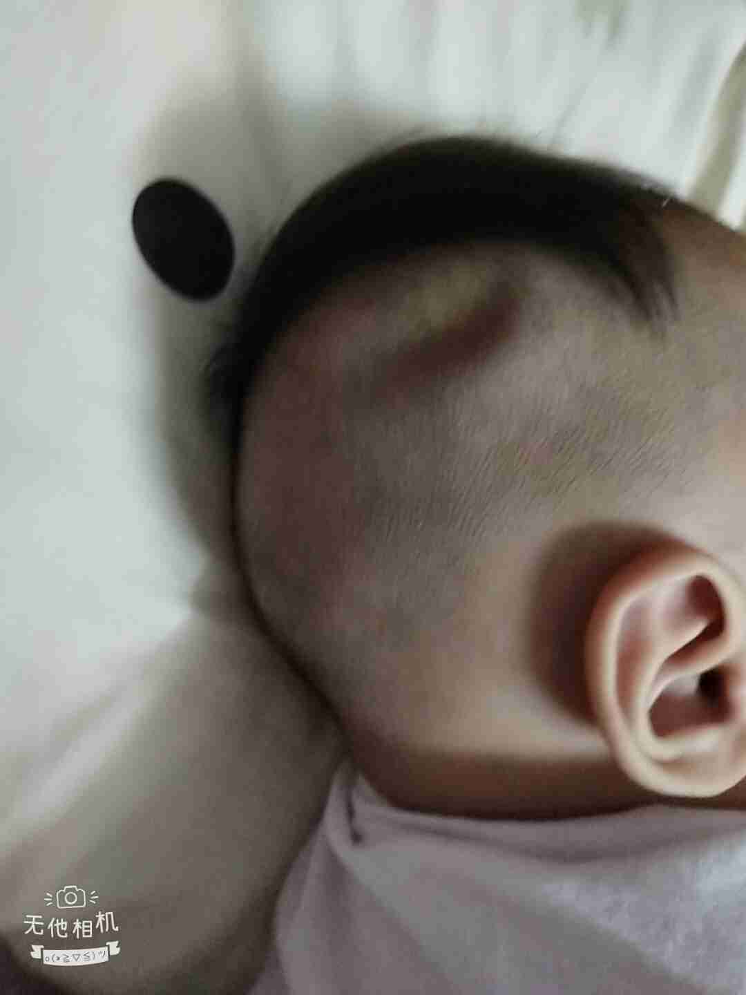 枕骨、 前额、太阳穴：多维度的潜力预示