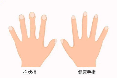 各脚趾的理想形态标准