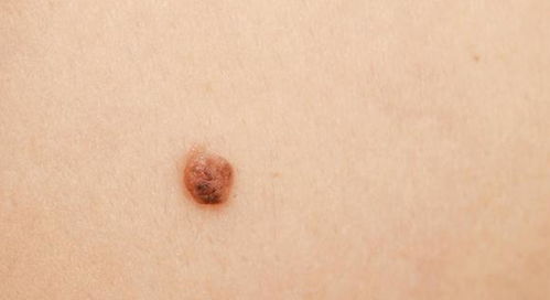 四、 现代医学视角下的科学解释