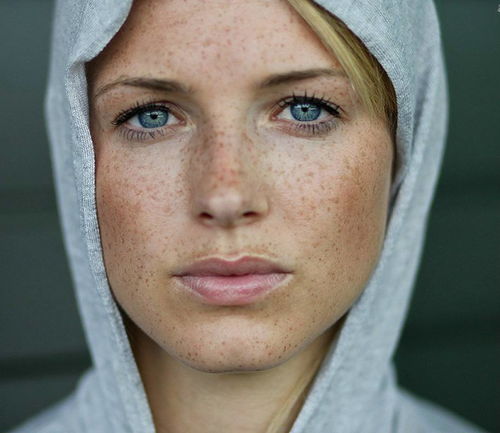 脸上雀斑如何用土办法有效淡化？