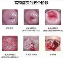 1.1 为哪些要贴膜？