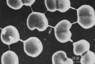 3. 念珠菌性阴道炎