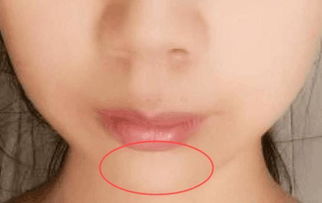 微表情与健康信号