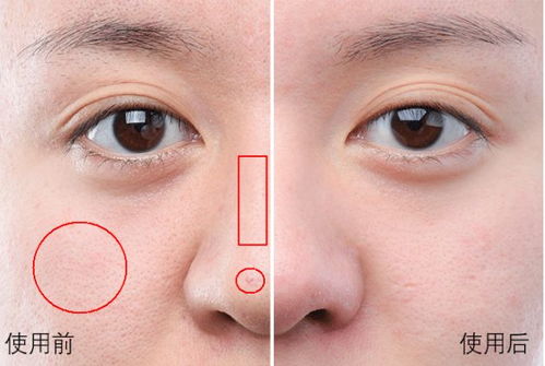 一、 厚唇（香肠嘴）的病理学阐释与临床表现