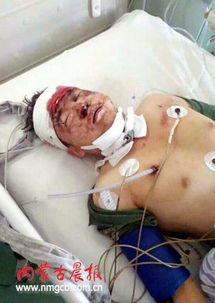 梦见朋友病情危重即将离世预示着什么？