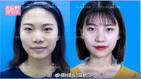 女性龙鼻人的性格